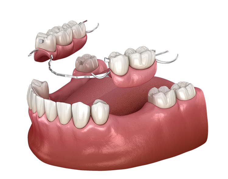 dentures near me winchester nv 89110